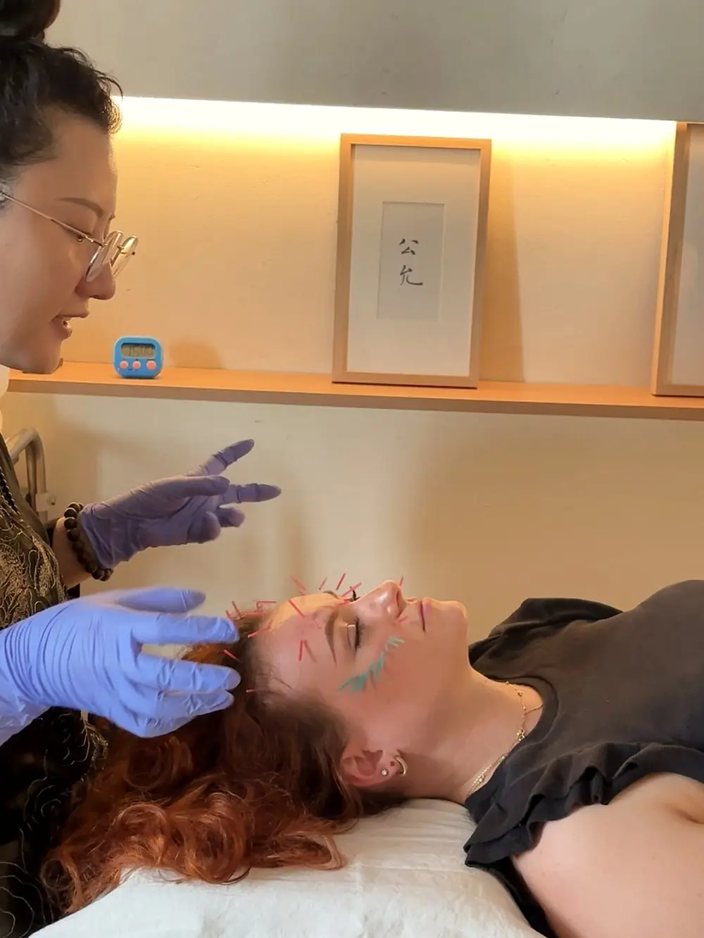 Facial acupuncture treatment in a private clinic room
